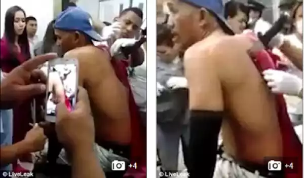 Photos: Man Seemed Completely Relaxed As Huge Knife Was Removed From His Back